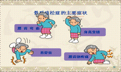 13.gif 13.gif