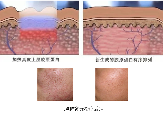 QQ图片20180615111306.png QQ图片20180615111306.png