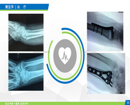 clip_image002.png clip_image002.png