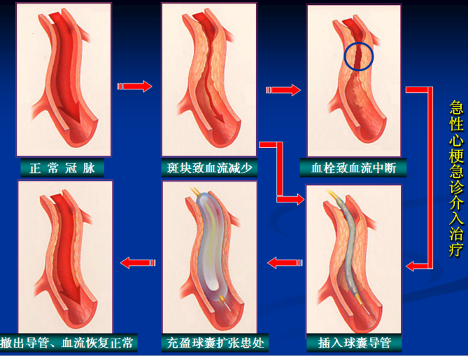 14.png 14.png